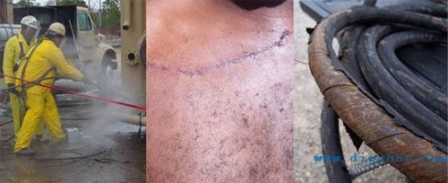 �߉���ϴ�C(j��)�����Б�(y��ng)ע��İ�ȫ���}